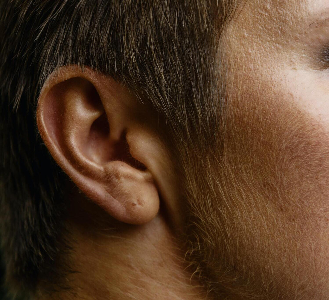 5 Easy Home Remedies For Itchy Ears