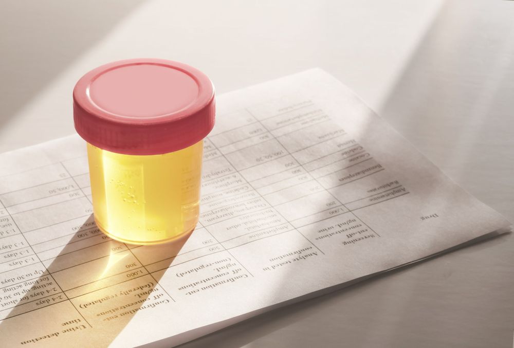 Urine Color Chart: What The Color of Your Urine Says About Your Health